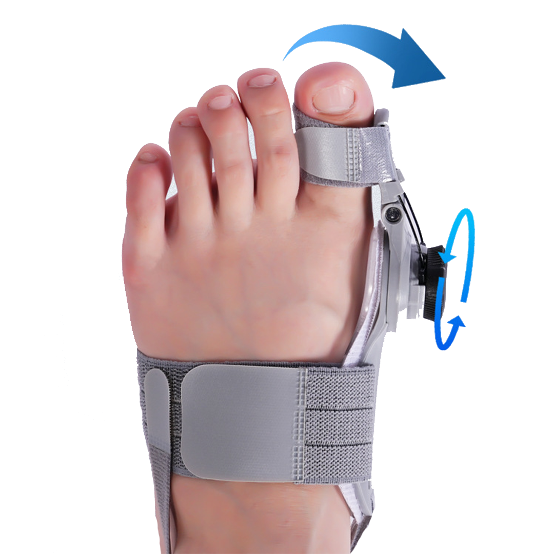 ✨ Bunion Fix - Natural At-Home Bunion Relief