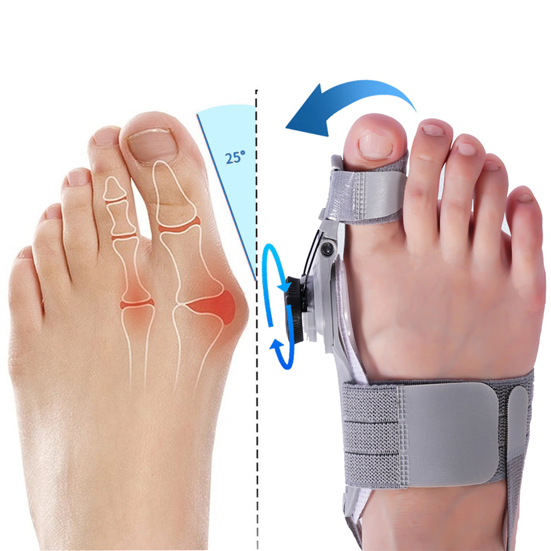 ✨ Bunion Fix - Natural At-Home Bunion Relief